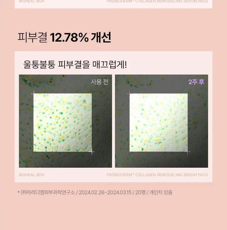 [모공고민|닦팩토듀얼] 바이오힐보 프로바이오덤 콜라겐 리모델링 세럼 패드 70매 상세페이지 6